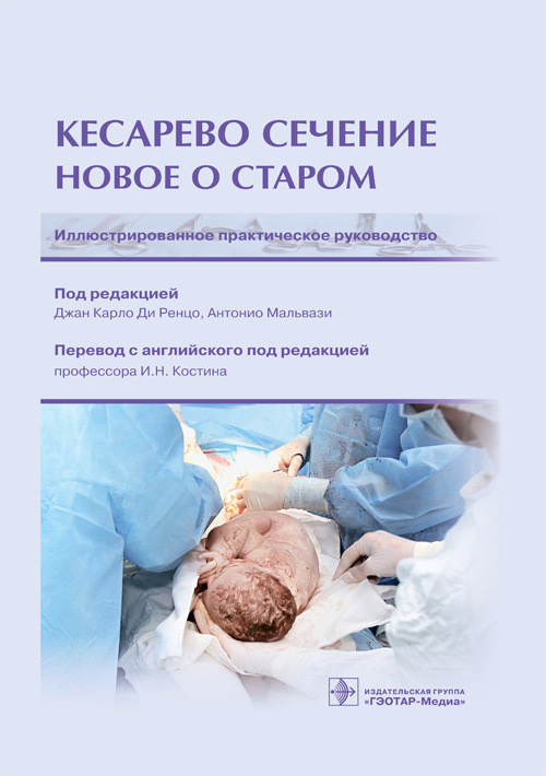 Кесарево сечение.Новое о старом.Иллюстрированное практическое руководство