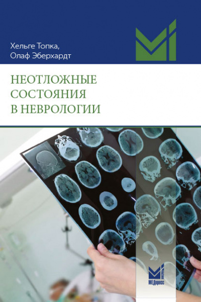 Неотложные состояния в неврологии