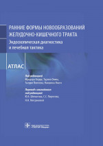 Ранние формы новообразований желудочно-кишечного тракта. Эндоскопическая диагностика и лечебная такт