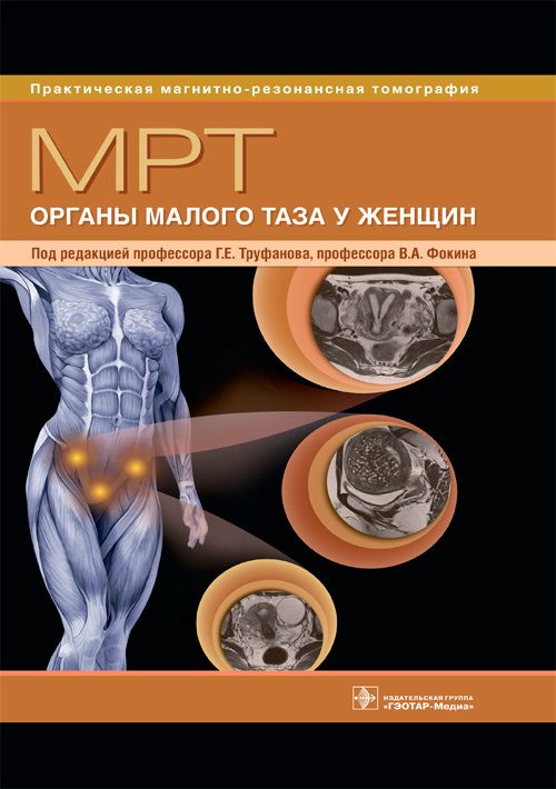 МРТ. Органы малого таза у женщин. Руководство