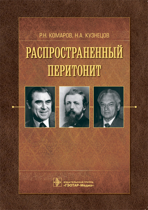 Распространенный перитонит. Руководство