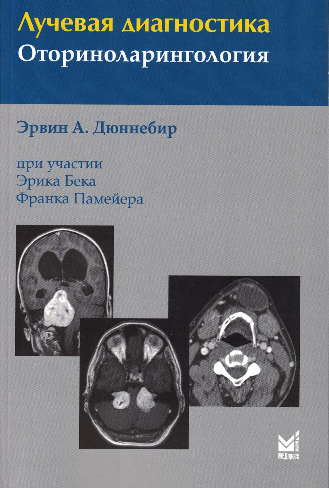 Лучевая диагностика. Оториноларингология