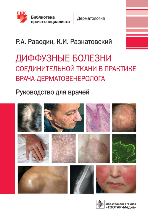 Диффузные болезни соединительной ткани в практике врача-дерматовенеролога. Библиотека врача-специалиста (эл.версия)