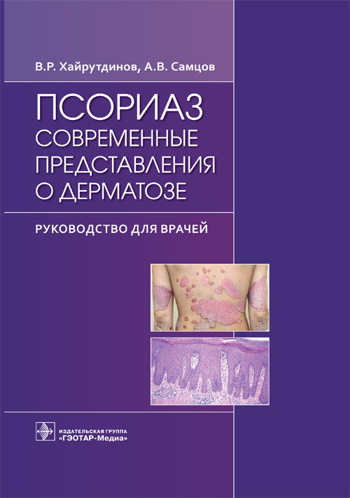 Псориаз. Современные представления о дерматозе. Руководство