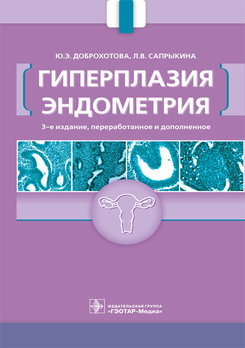 Гиперплазия эндометрия (эл.версия)