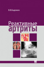 Реактивные артриты