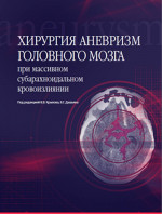 Хирургия аневризм головного мозга. При массивном субарахноидальном кровоизлиянии