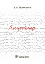 Альцгеймер