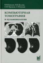 Компьютерная томография в пульмонологии. 3-е изд., доп