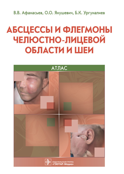 Афанасьев, Янушевич, Ургуналиев: Абсцессы и флегмоны челюстно-лицевой области и шеи. Атлас. Учебное пособие