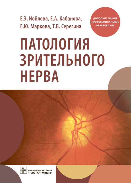 Патология зрительного нерва