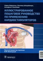 Иллюстрированное пошаговое руководство по применению кардиостимуляторов