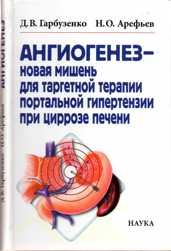 Ангиогенез - новая мишень для таргетной терапии портальной гипертензии при циррозе печени