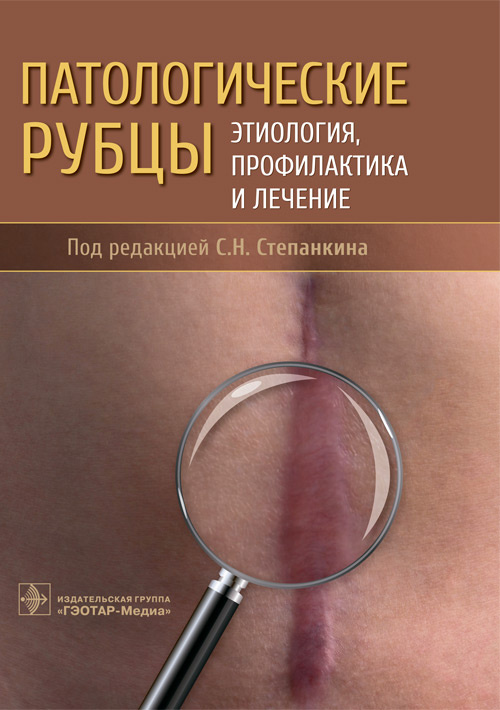 Сергей Степанкин: Патологические рубцы. Этиология, профилактика и лечение