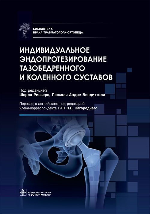Индивидуальное эндопротезирование тазобедренного и коленного суставов