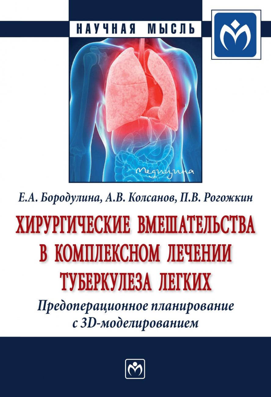 Хирургические вмешательства в комплексном лечении туберкулеза легких. Предоперационное планирование с 3D моделированием. Монография