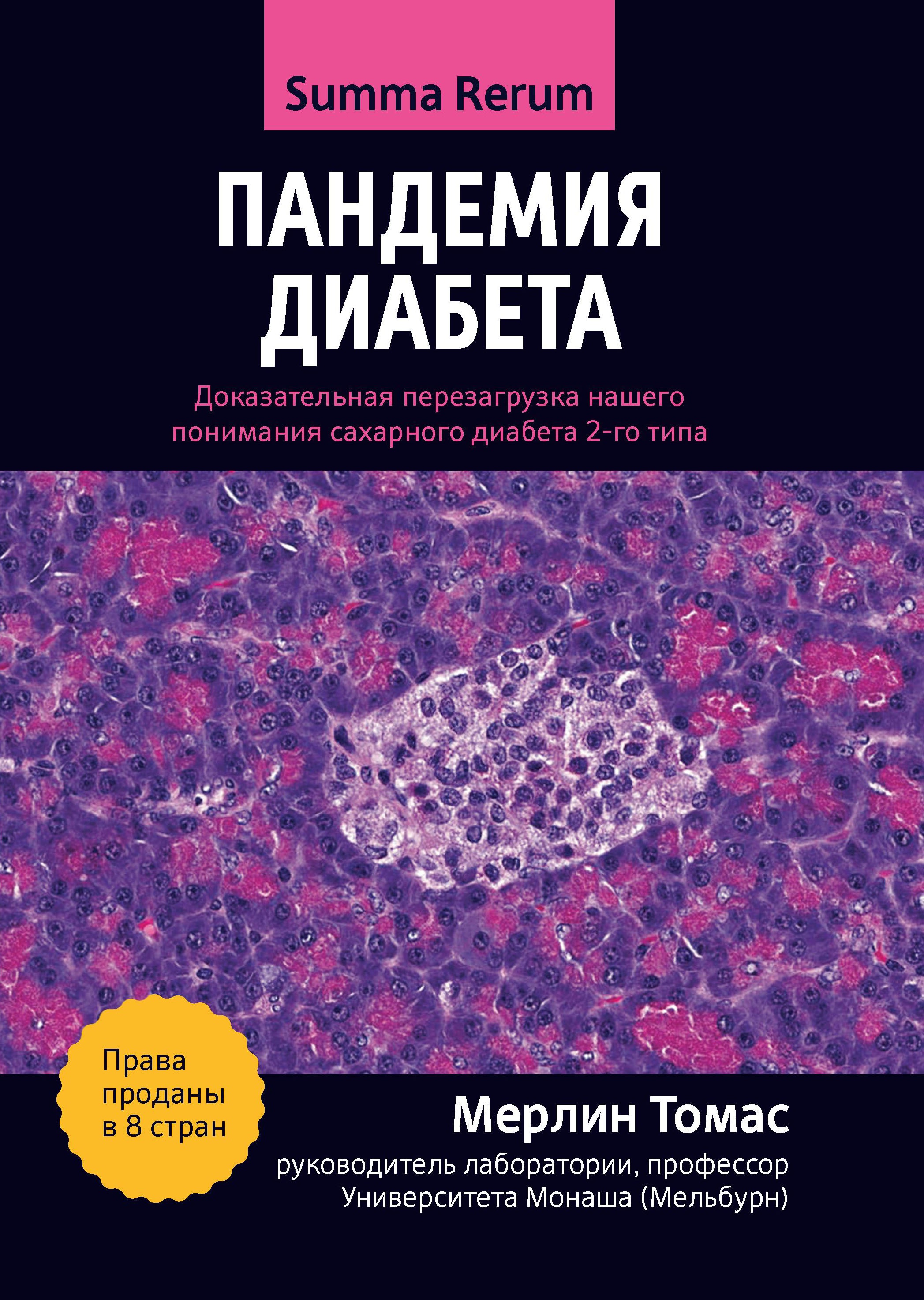 Мерлин Томас: Пандемия диабета. Доказательная перезагрузка нашего понимания сахарного диабета 2-го типа