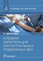 Клеевая облитерация магистральных подкожных вен