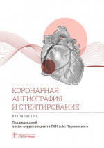 Коронарная ангиография и стентирование.Руководство