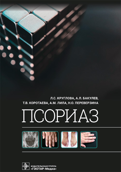Лариса Круглова: Псориаз