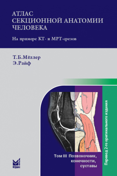 Атлас секционной анатомии. Т.3. Позвоночник, конечности, суставы