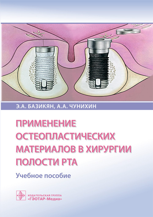 Базикян, Чунихин: Применение остеопластических материалов в хирургии полости рта