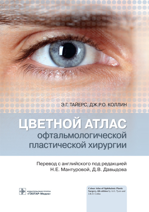 Тайерс, Коллин: Цветной атлас офтальмологической пластической хирургии