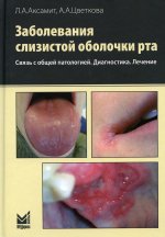 Заболевания слизистой оболочки рта