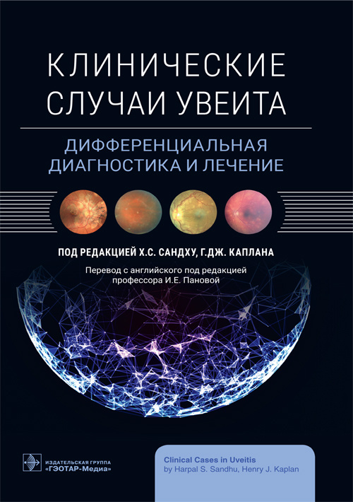 Клинические случаи увеита. Дифференциальная диагностика и лечение