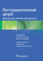 Посттравматический артрит. Диагностика, лечение и результаты