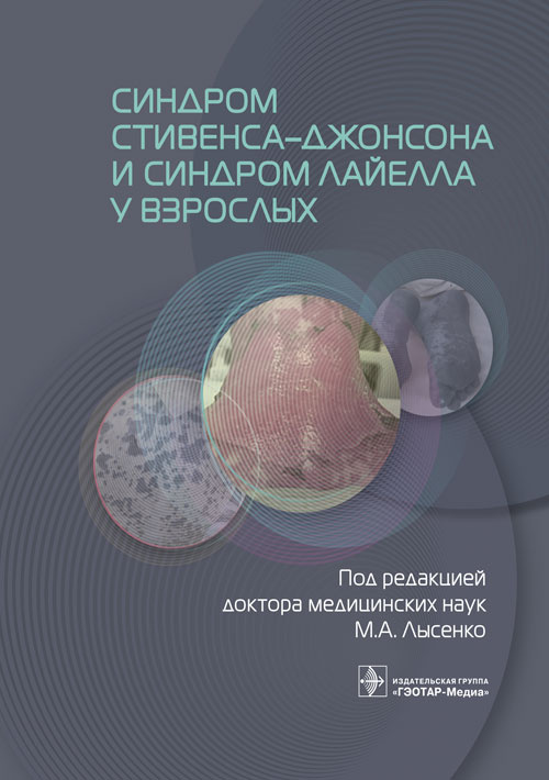 Лысенко, Проценко, Фомина: Синдром Стивенса-Джонсона и синдром Лайелла у взрослых