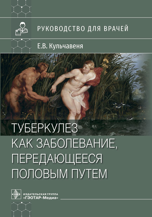 Екатерина Кульчавеня: Туберкулез как заболевание, передающееся половым путем. Руководство