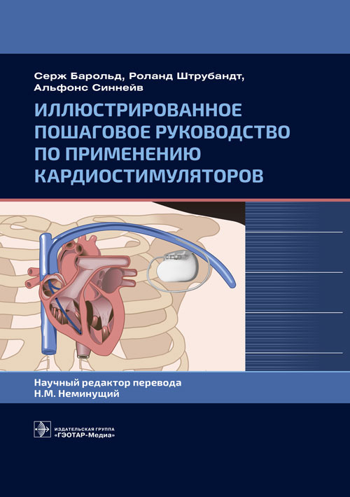 Барольд, Штрубандт, Синнейв: Иллюстрированное пошаговое руководство по применению кардиостимуляторов