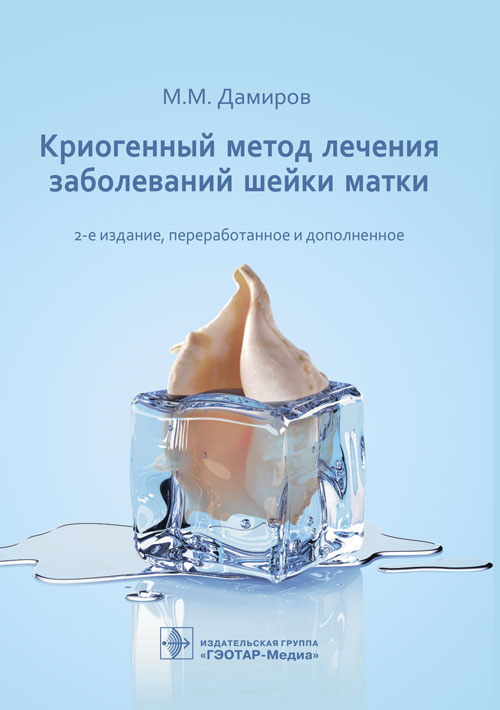 Михаил Дамиров: Криогенный метод лечения заболеваний шейки матки