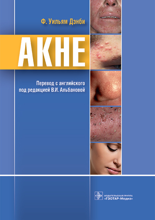 Ф. Дэнби: Акне