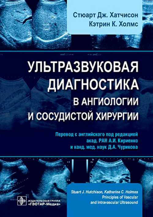 Хатчисон, Холмс: Ультразвуковая диагностика в ангиологии и сосудистой хирургии