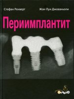 Стефан Ренверт, Жан-Луи Джованьоли "Периимплантит", М., 2014, 255 стр., 1197 иллюстр