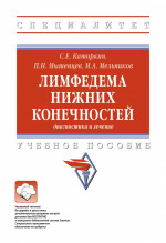 Лимфедема нижних конечностей: диагностика и лечение