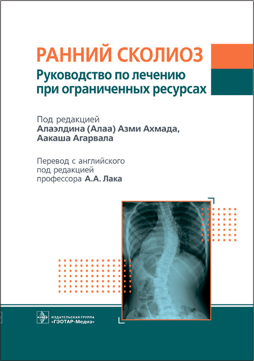 Ранний сколиоз.Руководство по лечению при ограниченных ресурсах