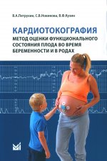 Кардиотокография - метод оценки функционального состояния плода во время беременности