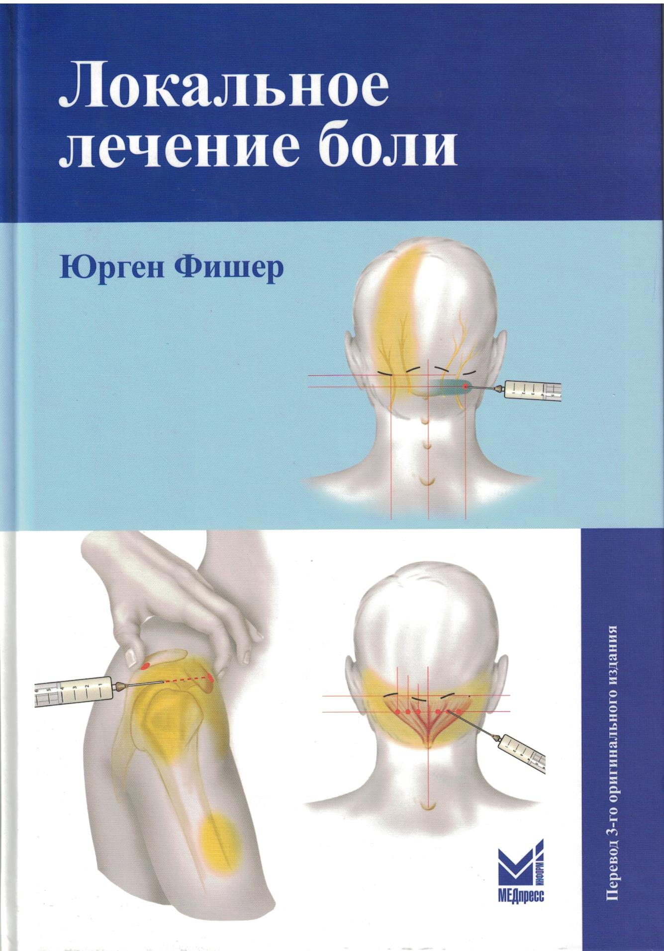 Локальное лечение боли