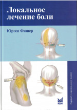 Локальное лечение боли