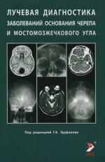 /Лучевая диагностика заболеваний оснований черепа и мостмозжечкового угла