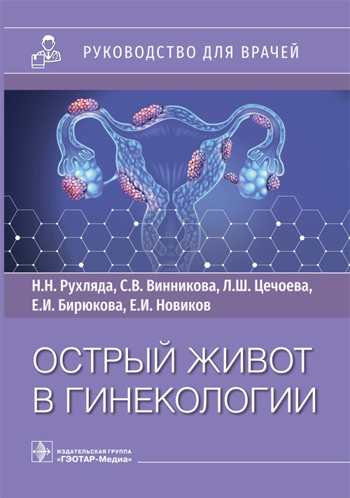 Николай Рухляда: Острый живот в гинекологии. Руководство