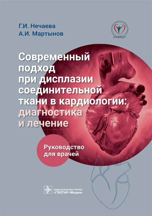 Современный подход при дисплазии соединительной ткани в кардиологии:диагностика и лечение
