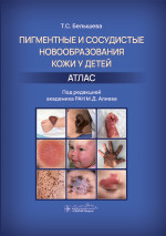 Пигментные и сосудистые новообразования кожи у детей