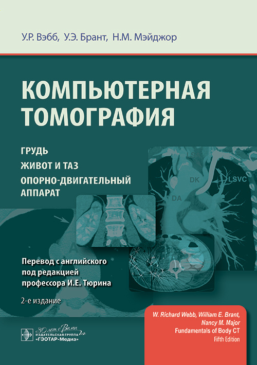 Компьютерная томография: грудь, живот и таз, опорно-двигательный аппарат / У. Р. Вэбб, У. Э. Брант, Н. М. Мэйджор ; пер. с англ. под ред. И. Е. Тюрина. — 2-е изд. — Москва : ГЭОТАР-Медиа, 2023. — 488 с. : ил