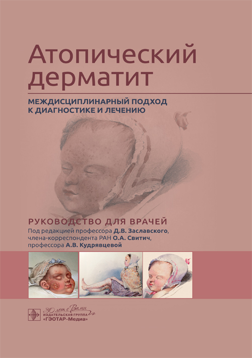 Атопический дерматит. Междисциплинарный подход к диагностике и лечению: руководство для врачей