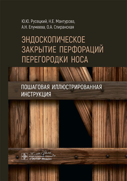Эндоскопическое закрытие перфораций перегородки носа.Пошаговая иллюстриров.инструкция
