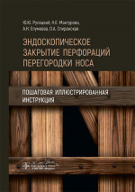 Эндоскопическое закрытие перфораций перегородки носа.Пошаговая иллюстриров.инструкция